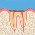 健康な歯の状態
